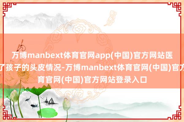 万博manbext体育官网app(中国)官方网站医师先仔细检察了孩子的头皮情况-万博manbext体育官网(中国)官方网站登录入口